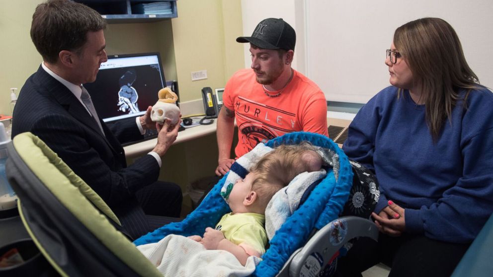 PHOTO: Bentley and his parents meet with Dr. John Meara, Plastic Surgeon-in-Chief, Boston Children's Hospital. 