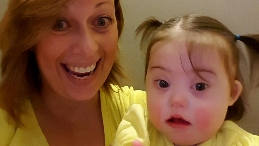 Mom Shares Post On Anniversary Of Daughters Down Syndrome Diagnosis Abc News 