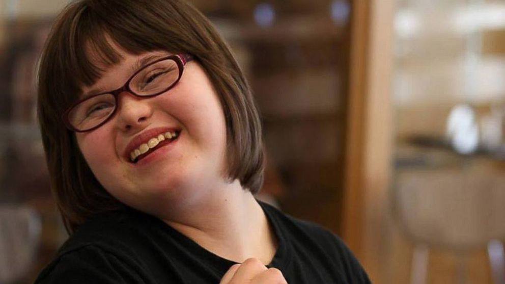 Karrie Brown, a 17-year old girl with down-syndrome, was recently given a modelling shoot with Wet Seal.