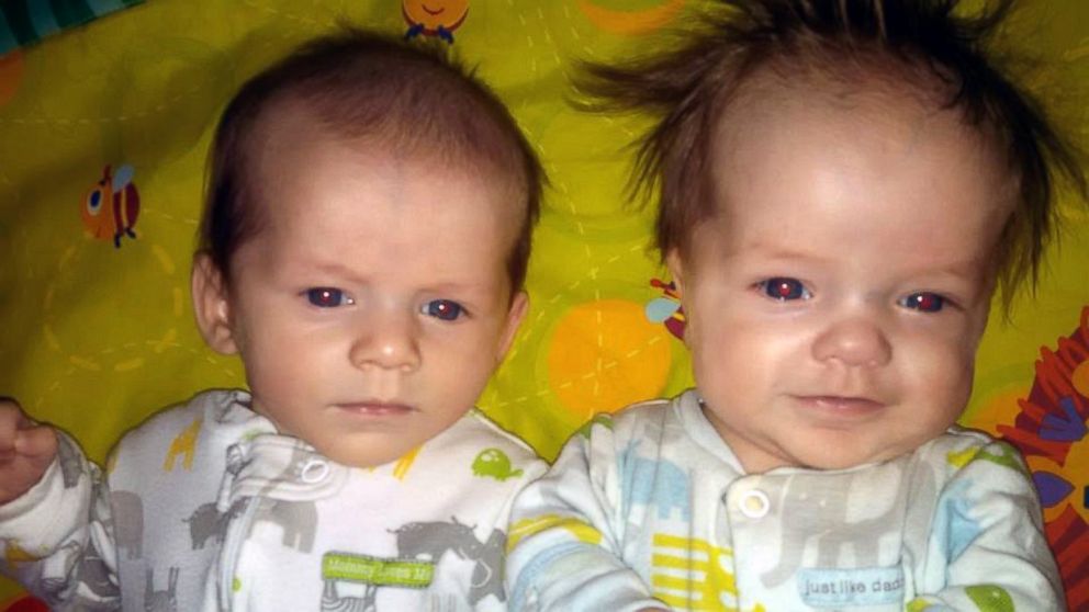 PHOTO: Dalen Lawler (right) was born with dwarfism. Twin brother Christian was not.