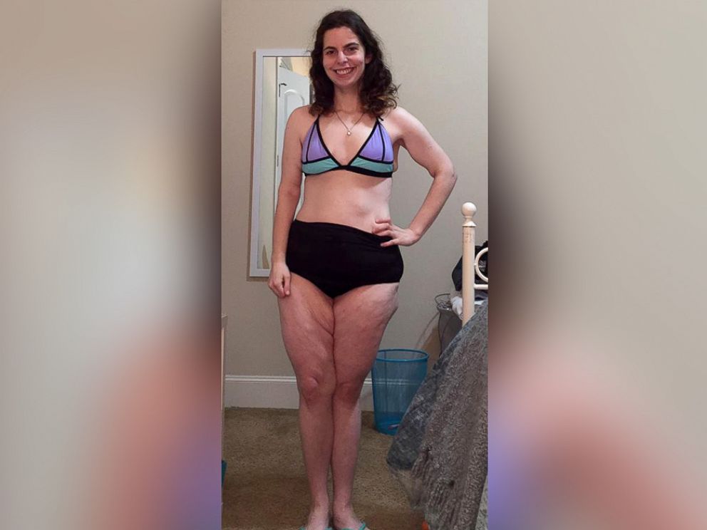 PHOTO: Lesley Miller, of Houston, Texas, explained why she bought her first bikini at age 21 in a now viral Facebook post.