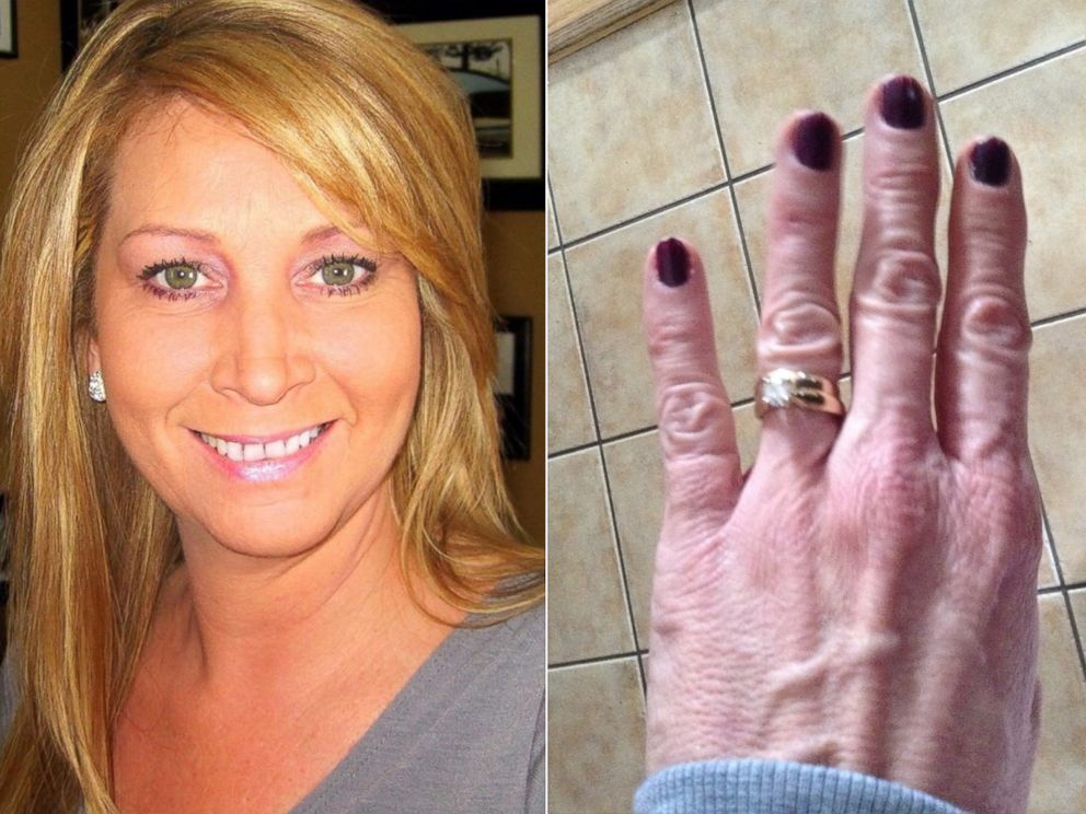 PHOTO:Woman's diamond anniversary ring returned three years after losing it walking the dog.