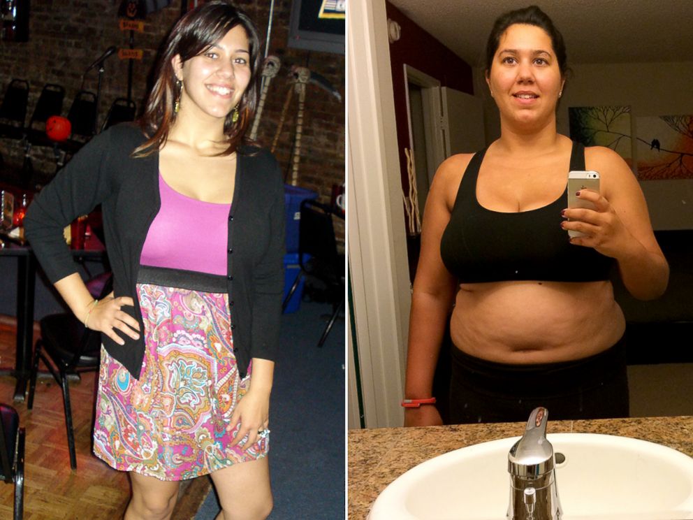PHOTO: Nancy Novo at her pre-weight gain weight and at the start of the new Weight Watchers coaching program.