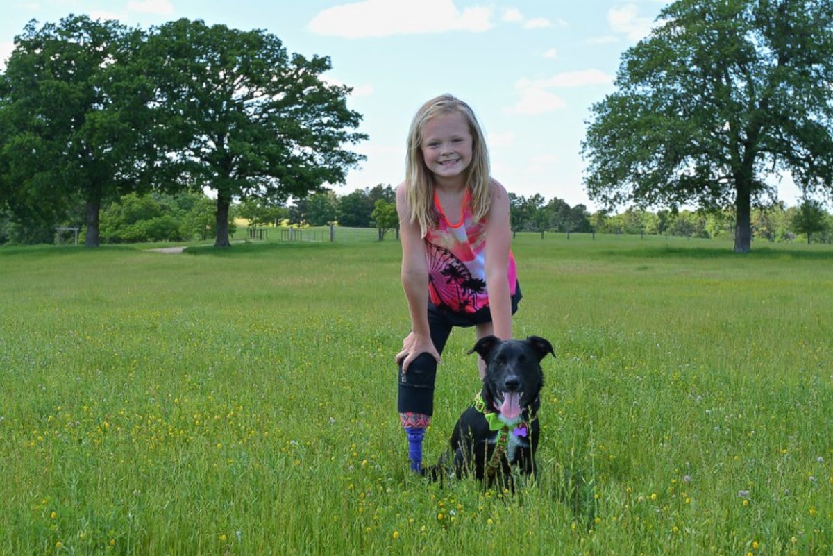 PHOTO: Averie Mitchell, 9, of Hugo, Oklahoma has adopted a dog named Hattie who has a prosthetic limb just like her. Hattie was adopted in May from The Underdogs Rescue in Oklahoma City. 