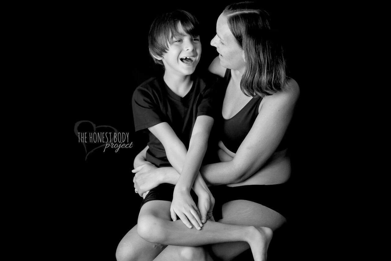 PHOTO: The "Defined by Our Hearts" photo series by The Honest Body Project celebrates the unbreakable bond between moms and their children with special needs. 