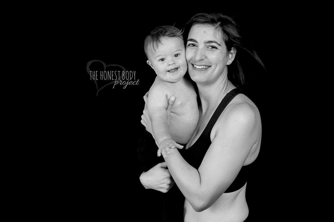 PHOTO: The "Defined by Our Hearts" photo series by The Honest Body Project celebrates the unbreakable bond between moms and their children with special needs. 