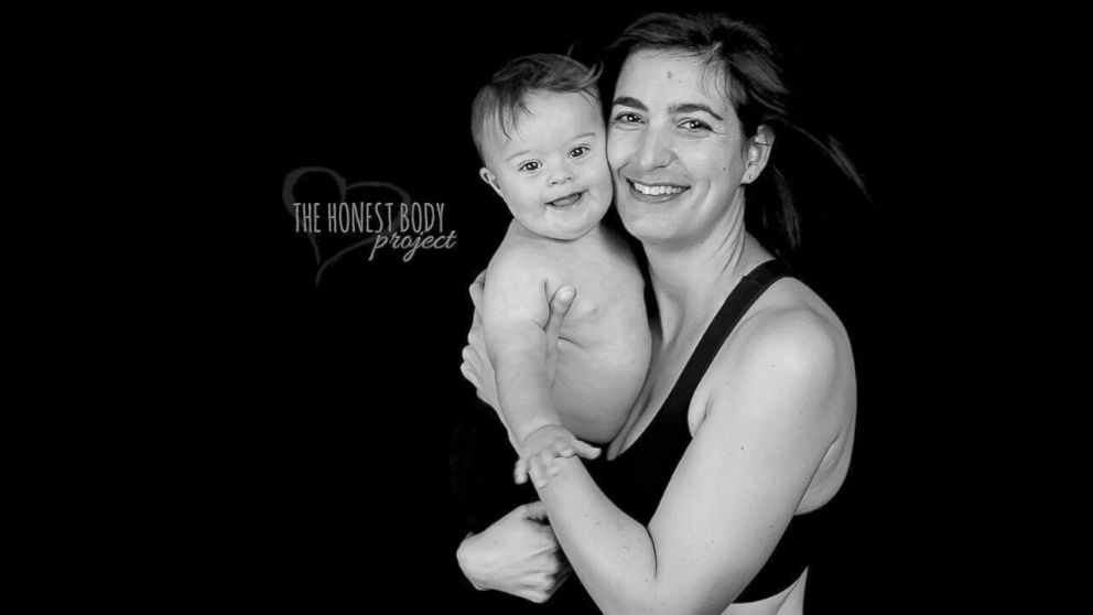 The "Defined by Our Hearts" photo series by The Honest Body Project celebrates the unbreakable bond between moms and their children with special needs. 