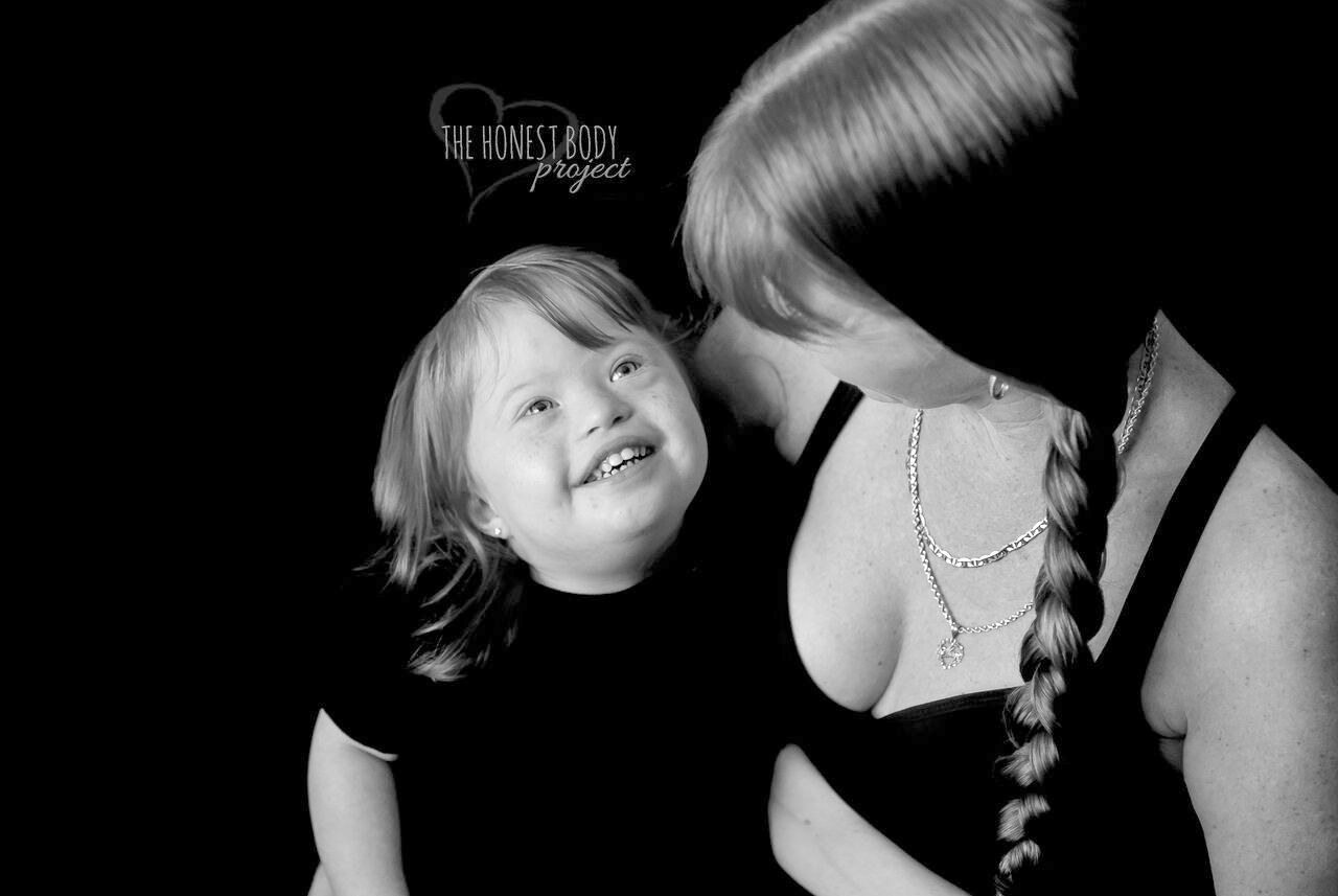 PHOTO: The "Defined by Our Hearts" photo series by The Honest Body Project celebrates the unbreakable bond between moms and their children with special needs. 