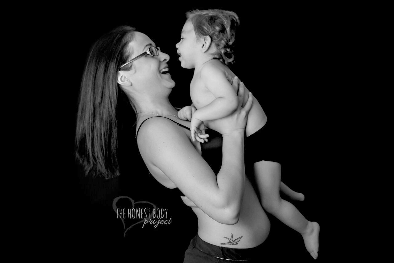 PHOTO: The "Defined by Our Hearts" photo series by The Honest Body Project celebrates the unbreakable bond between moms and their children with special needs. 