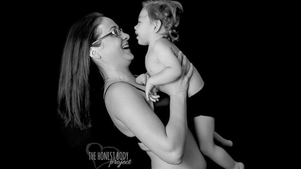 PHOTO: The "Defined by Our Hearts" photo series by The Honest Body Project celebrates the unbreakable bond between moms and their children with special needs. 