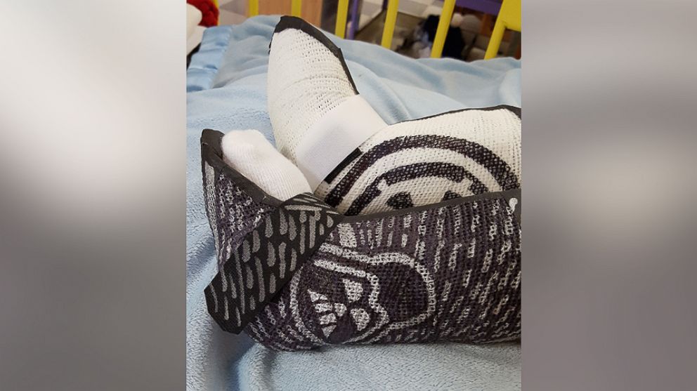 PHOTO: Physical therapist Amanda Hall created two casts inspired by "Star Wars" for a 1-year-old patient at her D.C. hospital.