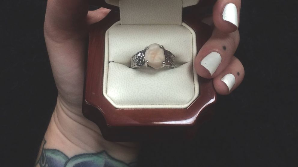 Carlee Leifkes' engagement ring, pictured here, is made from her fiance Lucas Unger's wisdom tooth. 