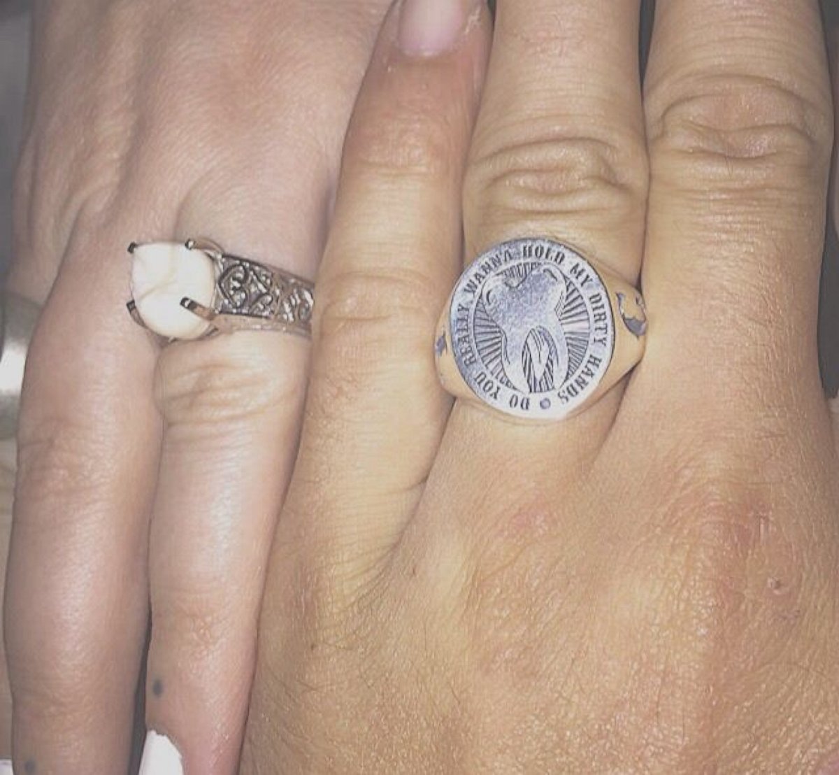 PHOTO: Carlee Leifkes' wedding ring is pictured here next to Lucas Unger's wedding ring. 