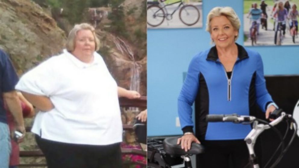 Woman’s Dramatic 280-Pound Weight Loss : ‘I Have My Life Back’
