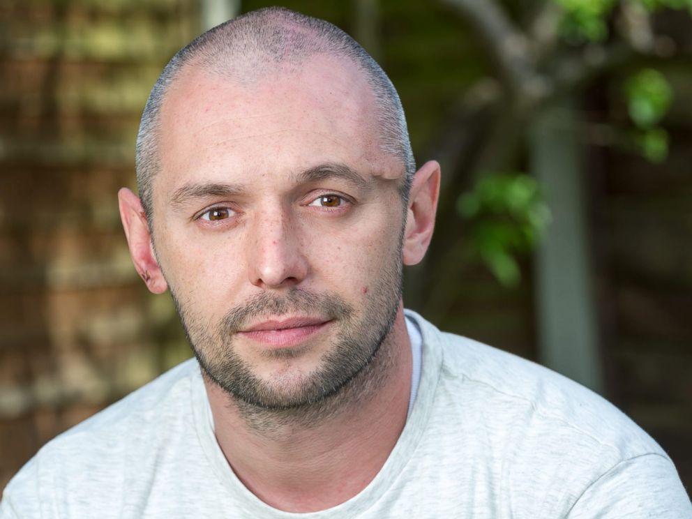 Man Missing Chunk of Skull Looks Great Thanks to Plate ABC News