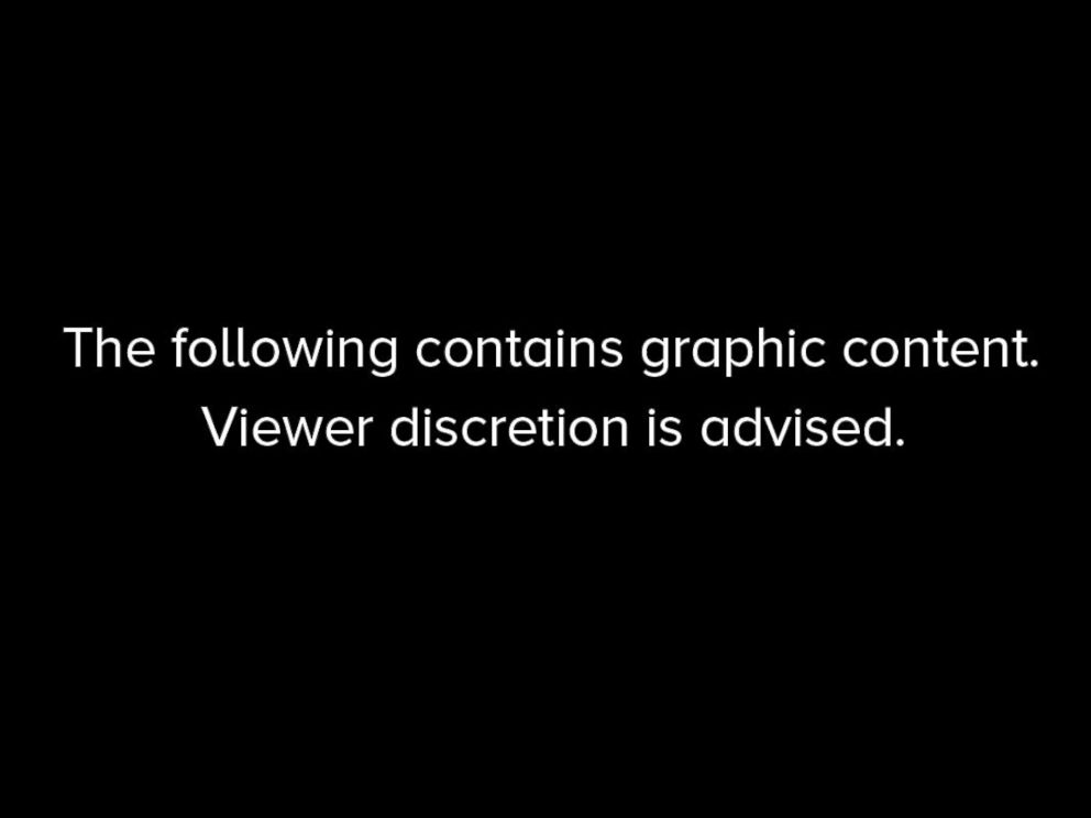PHOTO: The following contains graphic content. Viewer discretion is advised.