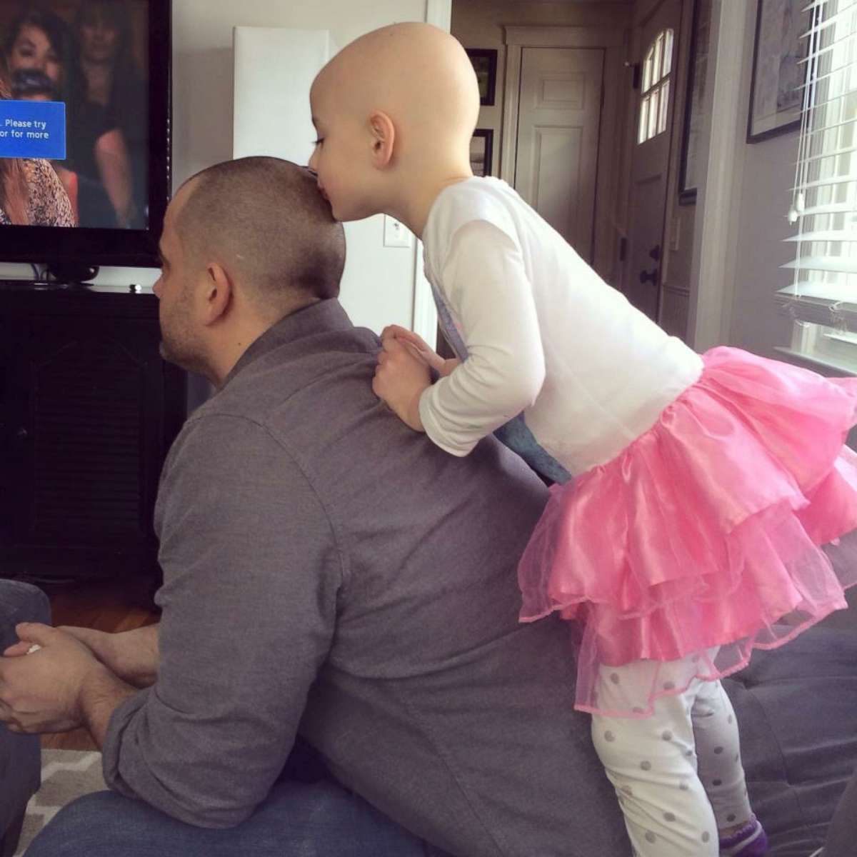 PHOTO:Riley Sylvaria, 6, who has alopecia, kisses her father Dave's head in a candid moment. 