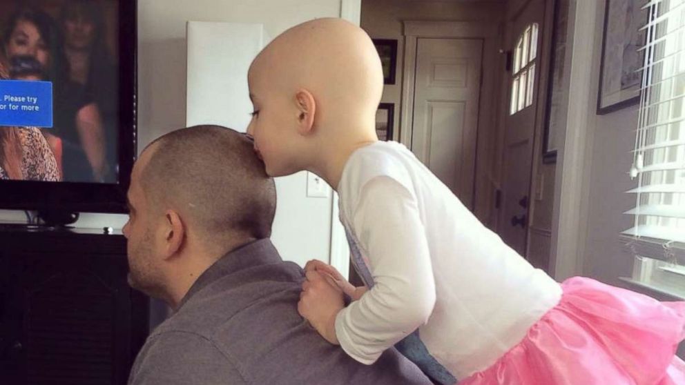 PHOTO:Riley Sylvaria, 6, who has alopecia, kisses her father Dave's head in a candid moment. 