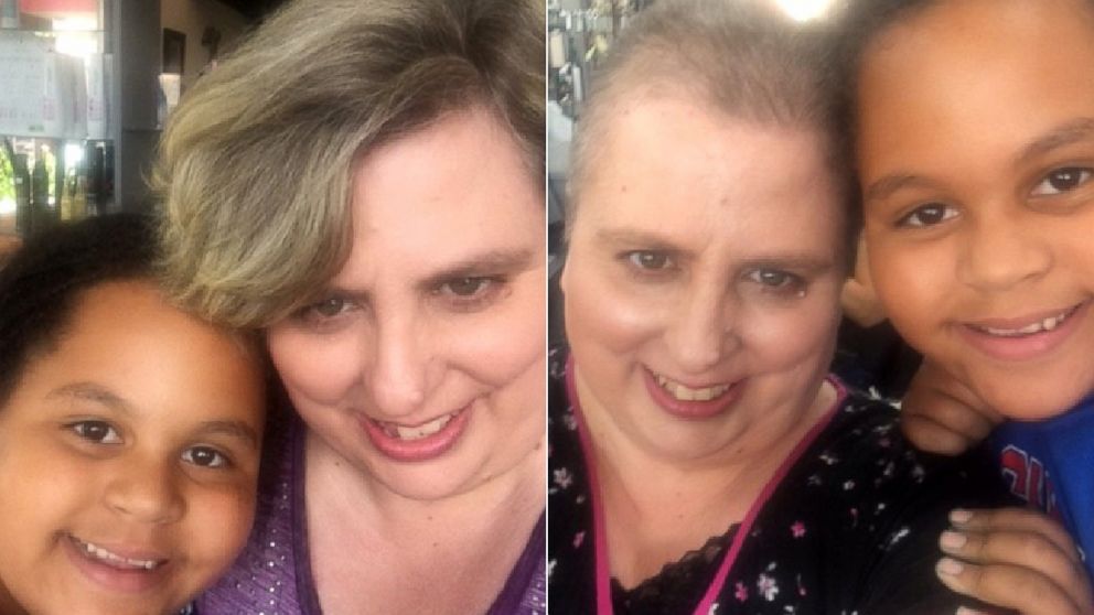 Olivia Ohlson, 10, poses with her mom, Gini Ohlson, before, left, and after Gini Ohlson lost her hair due to chemotherapy.