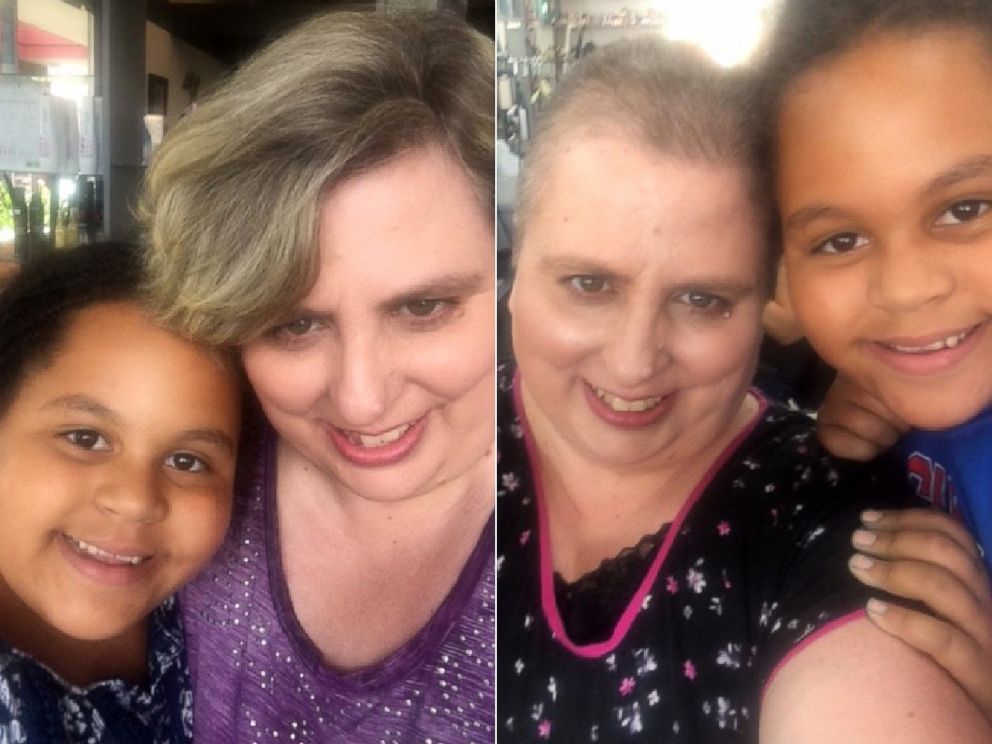 PHOTO: Olivia Ohlson, 10, poses with her mom, Gini Ohlson, before, left, and after Gini Ohlson lost her hair due to chemotherapy.