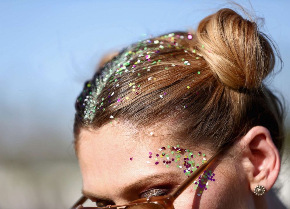 PHOTO: Glitter hair detail of festivalgoers during day 2 of the 2017 Coachella Valley Music & Arts Festival at the Empire Polo Club, April 22, 2017, in Indio, Calif.