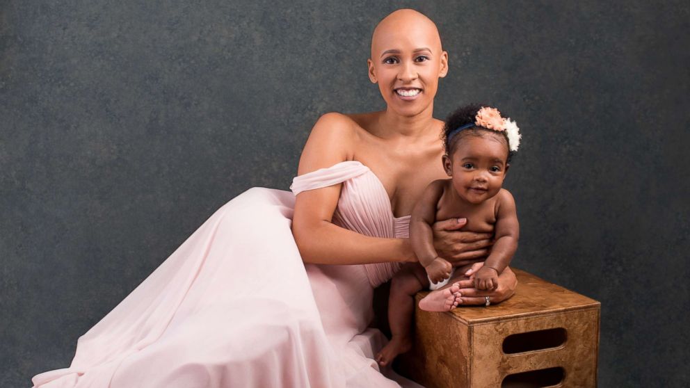 PHOTO: Courtni Guevara, who was diagnosed with alopecia last year, with her daughter, Zuri.