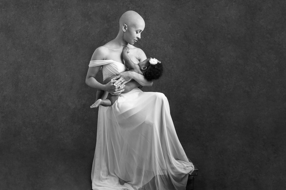 PHOTO: Courtni Guevara, of Laurel, Maryland, who was diagnosed with alopecia last year, with her daughter, Zuri.