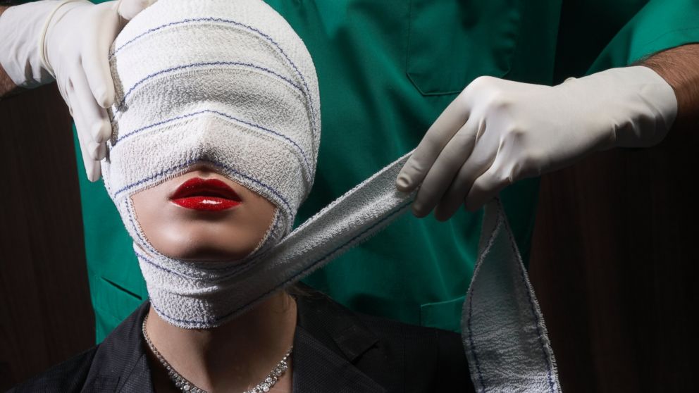 A woman is seen after a plastic surgery procedure in this undated stock photo. 