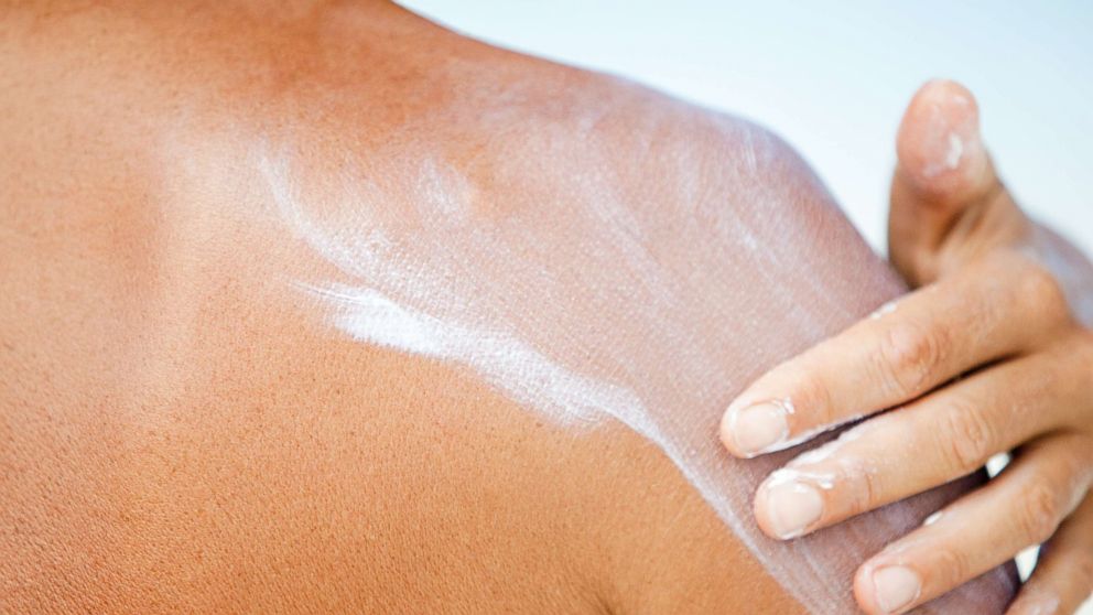 PHOTO:A person puts sunscreen on in this undated file photo.