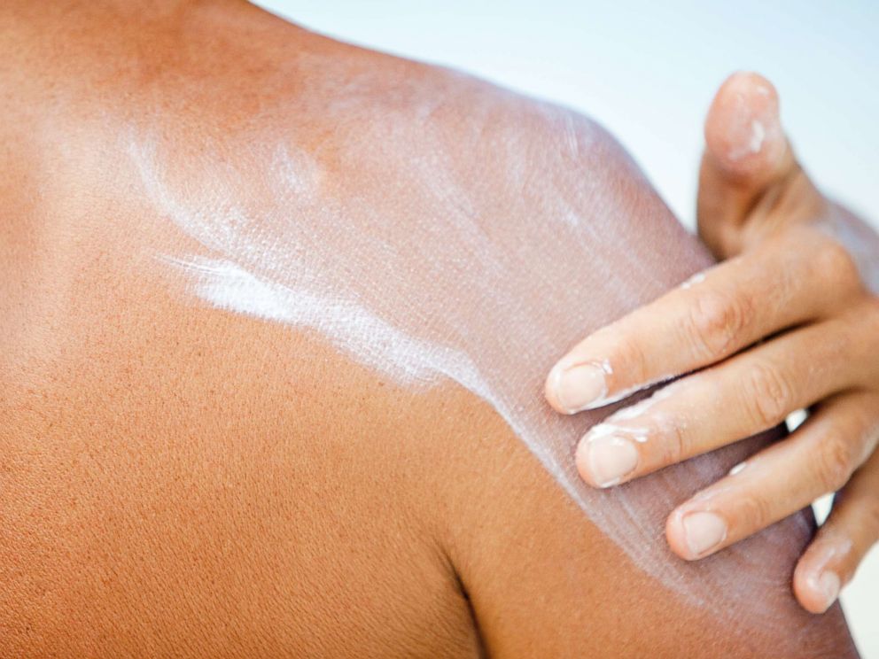 PHOTO:A person puts sunscreen on in this undated file photo.