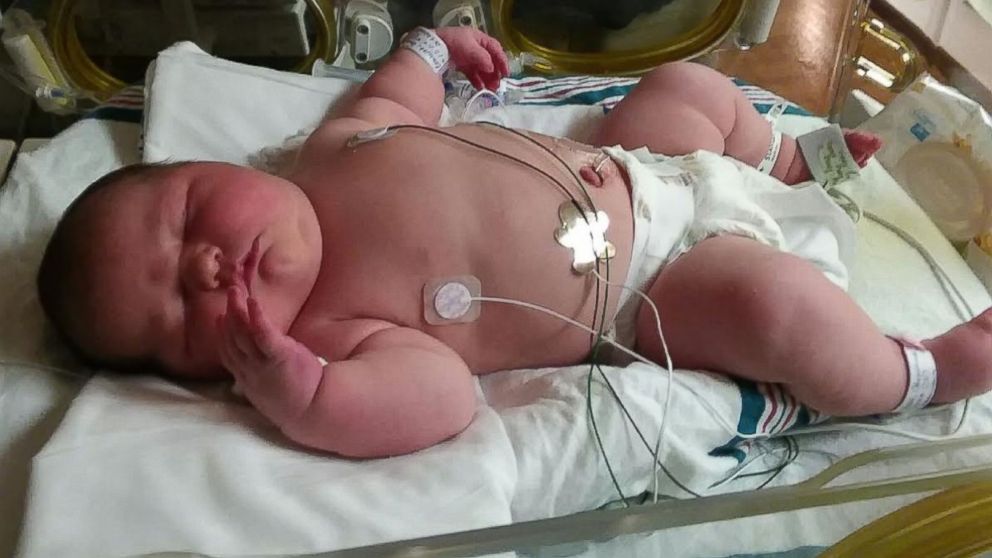 PHOTO: Chrissy Corbitt of Keystone Heights, Fla., gave birth to 13-pound, 5-ounce newborn, Carleigh Corbitt, on May 15, 2017.