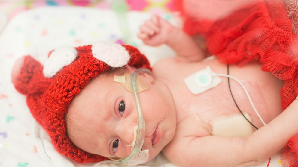 PHOTO: Cupid visited the preemies at Saint Luke's Hospital in Kansas City, Missouri, to celebrate Valentine's Day. 