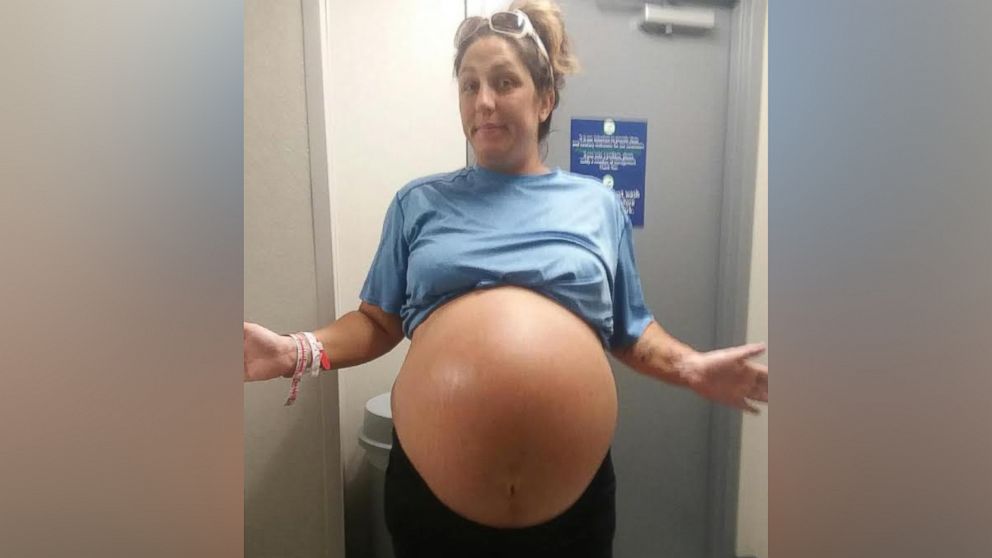 Florida mom gives birth to 13-pound baby: 'It looked like they pulled a  toddler out of my belly' - ABC News