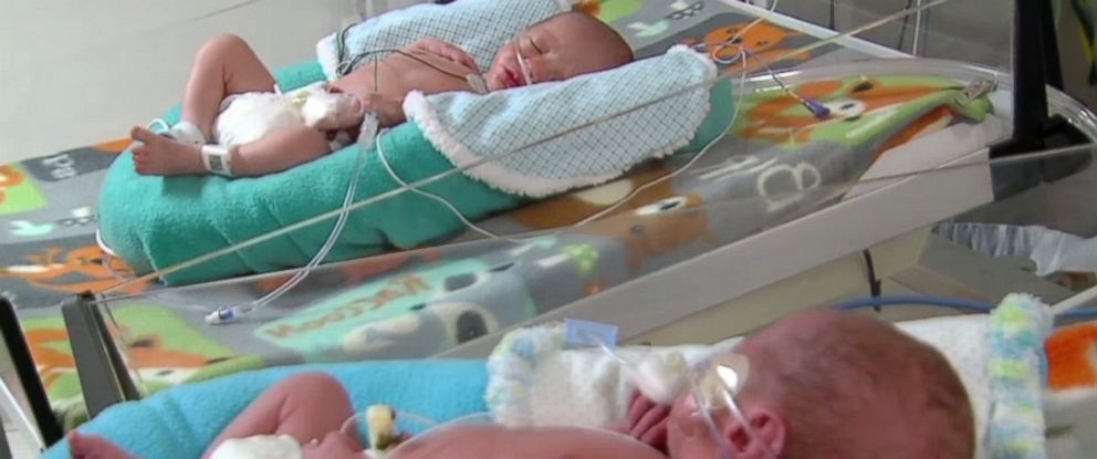 Parents Welcome New Year's Twins Born Minutes Apart, In Different Years ...