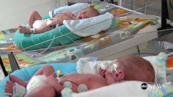 Parents Welcome New Year's Twins Born Minutes Apart, in Different Years ...