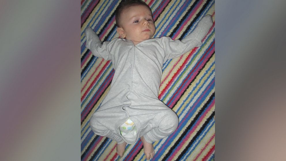 PHOTO:Gemma Davies snapped this photo of her son, Lenny, after his dad put on his clothes upside down.