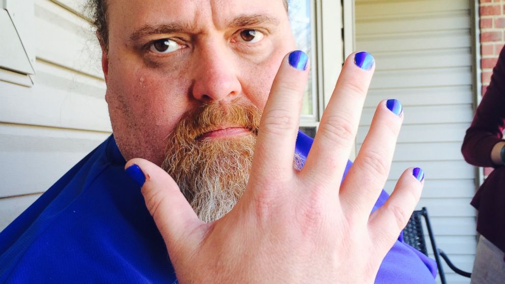 Louisiana dad Brian Batey paints his nails blue for Autism Awareness Month. 