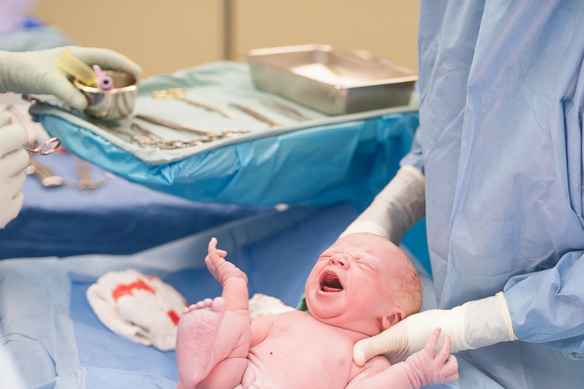 PHOTO: Photographer Jessica Bender photographed the birth of her friend's son via c-section. She hopes that by sharing the photos some of the fear and stigma associated with cesarean births will be eliminated. 
