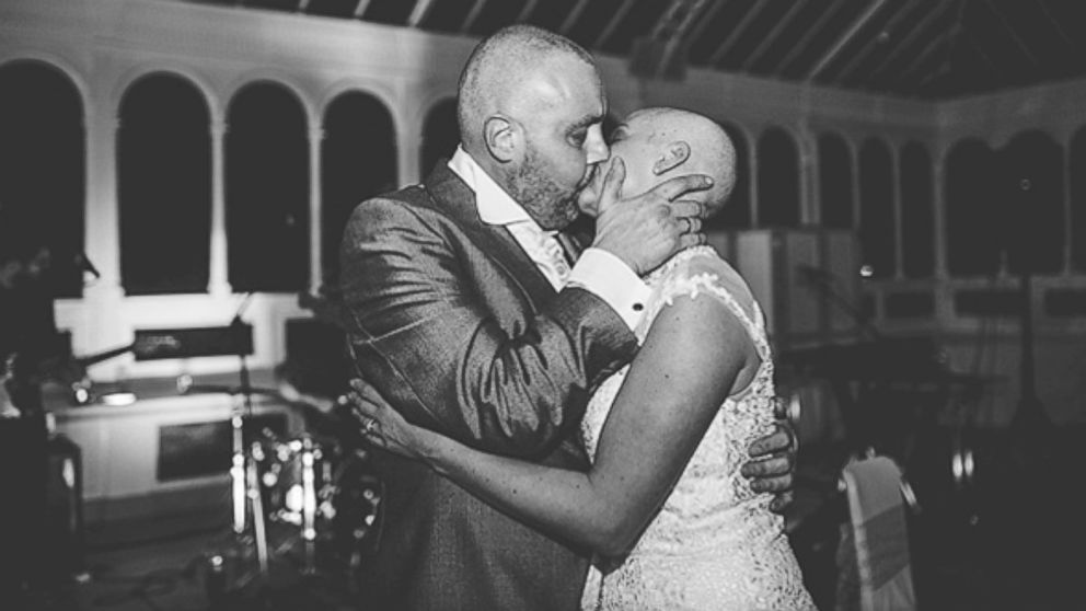 Joan Lyons had her head shaved for charity at the reception following her wedding with Craig Lyons in Liverpool, England.