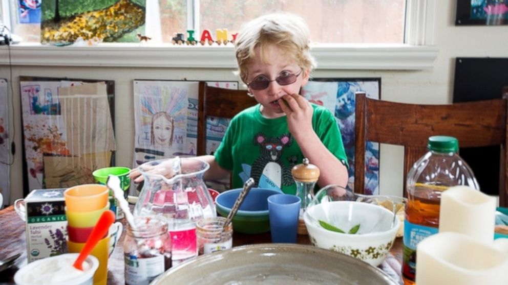 PHOTO: Photographer Karen Haberberg has started a Kickstarter campaign to finance her photo book on kids with rare genetic conditions. Ian (pictured) doesn't know when he is full.