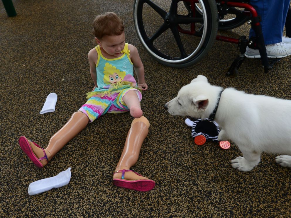 PHOTO: In an interview with the Greenville News, Sapphyre's mother said that her feet were amputated due to a birth defect to allow her daughter to be fitted for prosthetics.