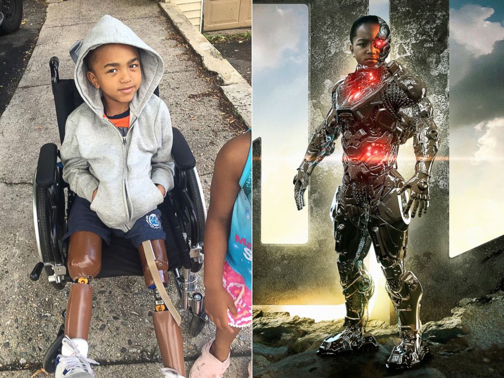 PHOTO: Kayden Kinckle has been a double amputee since he was 1 year old. | Kayden Kinckle as Cyborg. 