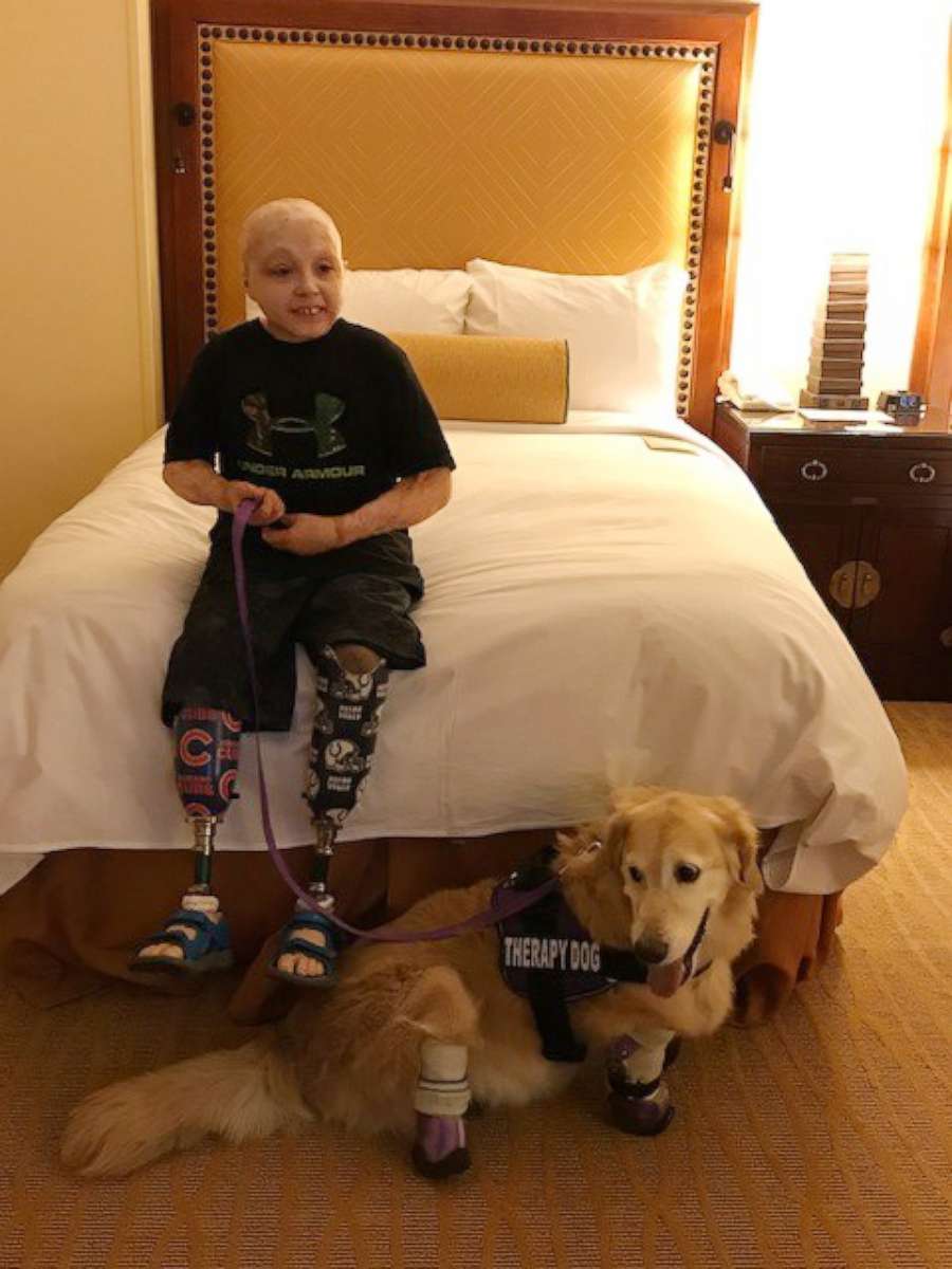 PHOTO: Owen Mahan, 10, meets Chi Chi, a quadruple amputee dog.