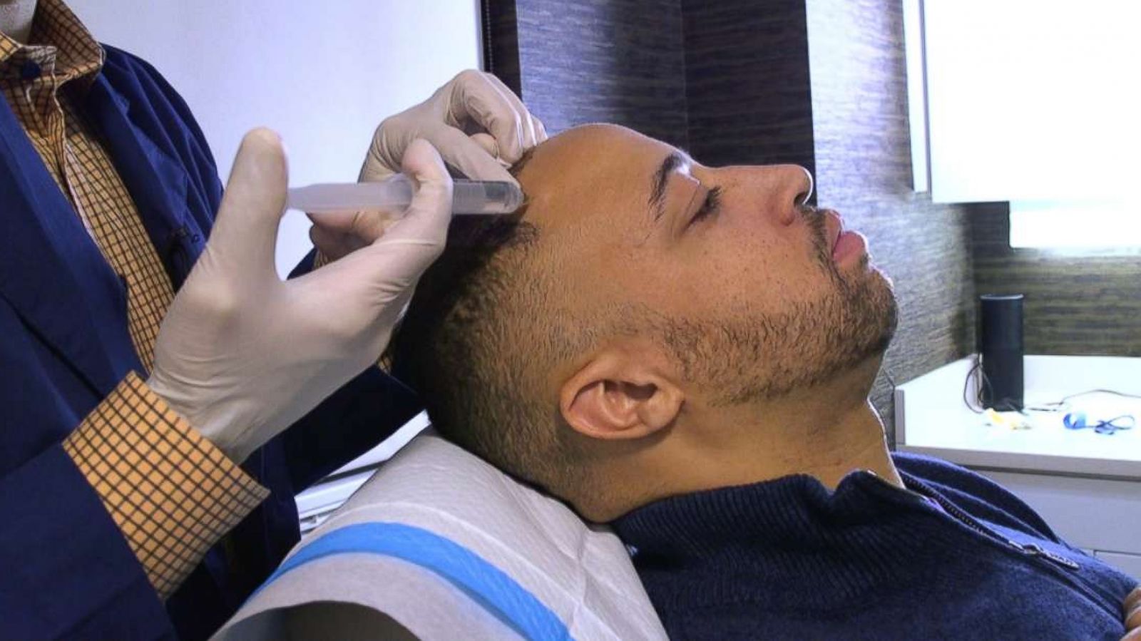 PHOTO: Justin Barton, a patient of Dr. Norman Rowe, receives platelet -rich plasma injections to stimulate hair growth.