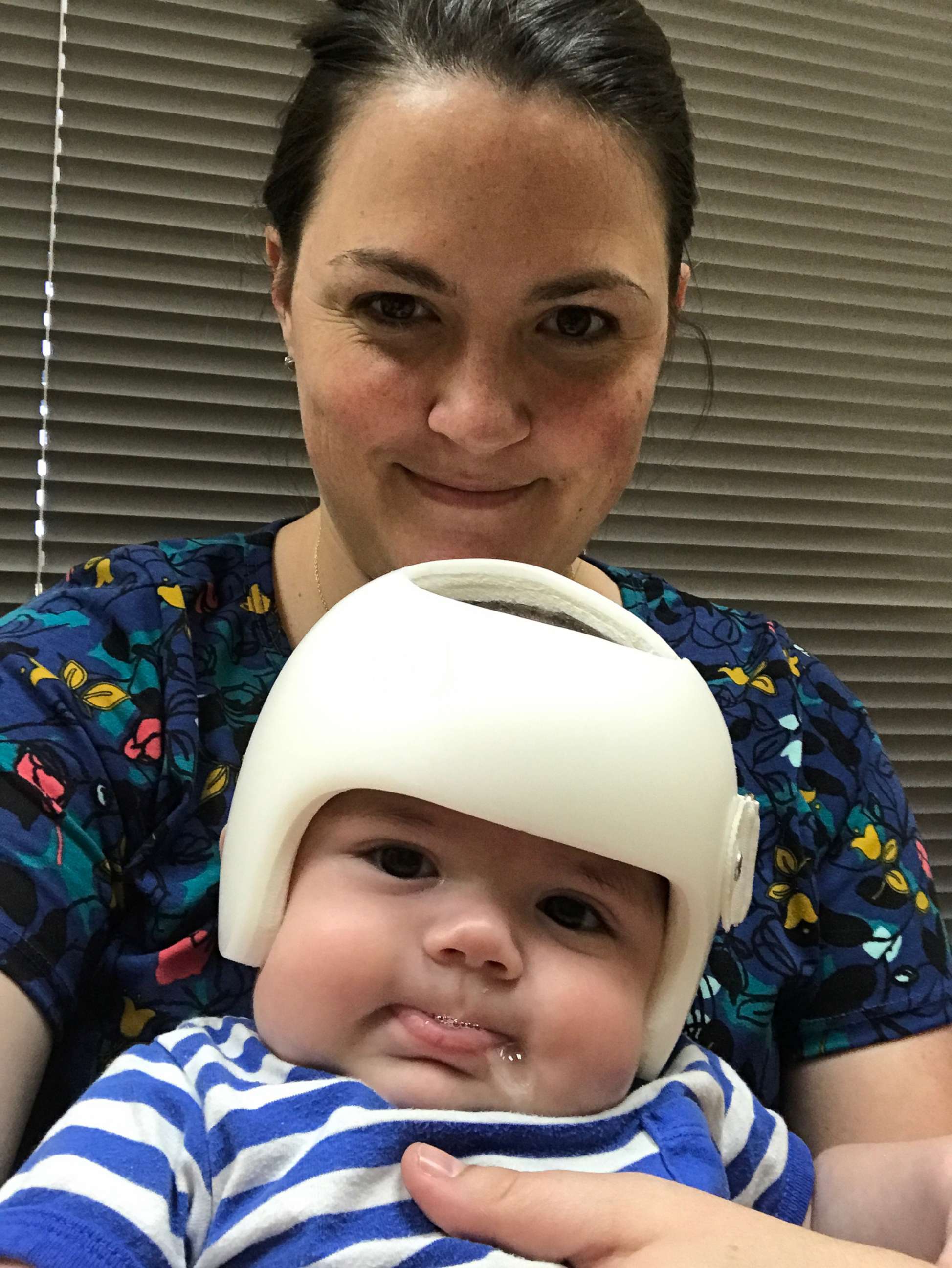 PHOTO: Mother of two Shayna Gutierrez with her 4-month-old Jonas Gutierrez, who was diagnosed with plagiocephaly in July.