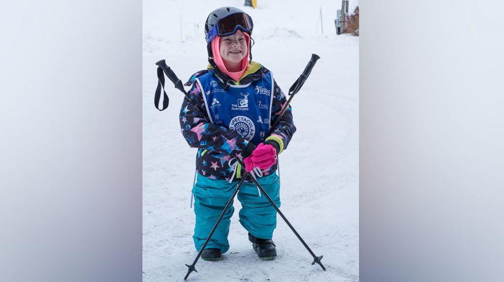 PHOTO: Lily Biagini, 10, a double amputee, learned to snowboard in Breckenridge, Colo.
