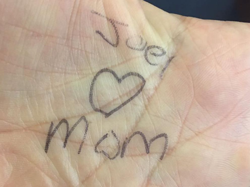 PHOTO: Joel Gannon, 9, who has Goldenhar Syndrome, wrote this on his mother Stacey's hand after she comforted him after being ridiculed at church.