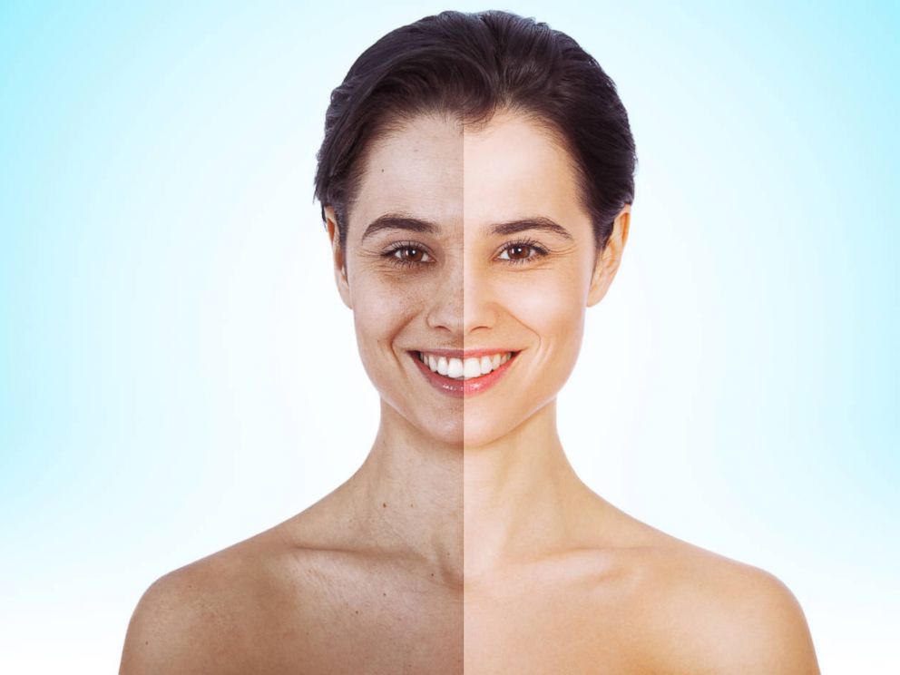 PHOTO: As of Oct. 1, Getty Images will not accept creative content where models body shapes have been retouched to make them look thinner or larger. Changes to hair color, nose shape and retouching of skin or blemishes are still acceptable.