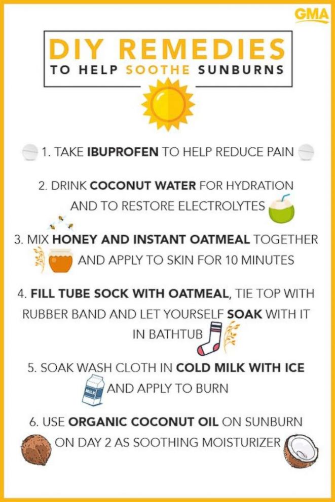 At Home Remedies To Help Soothe Skin After A Sunburn ABC News