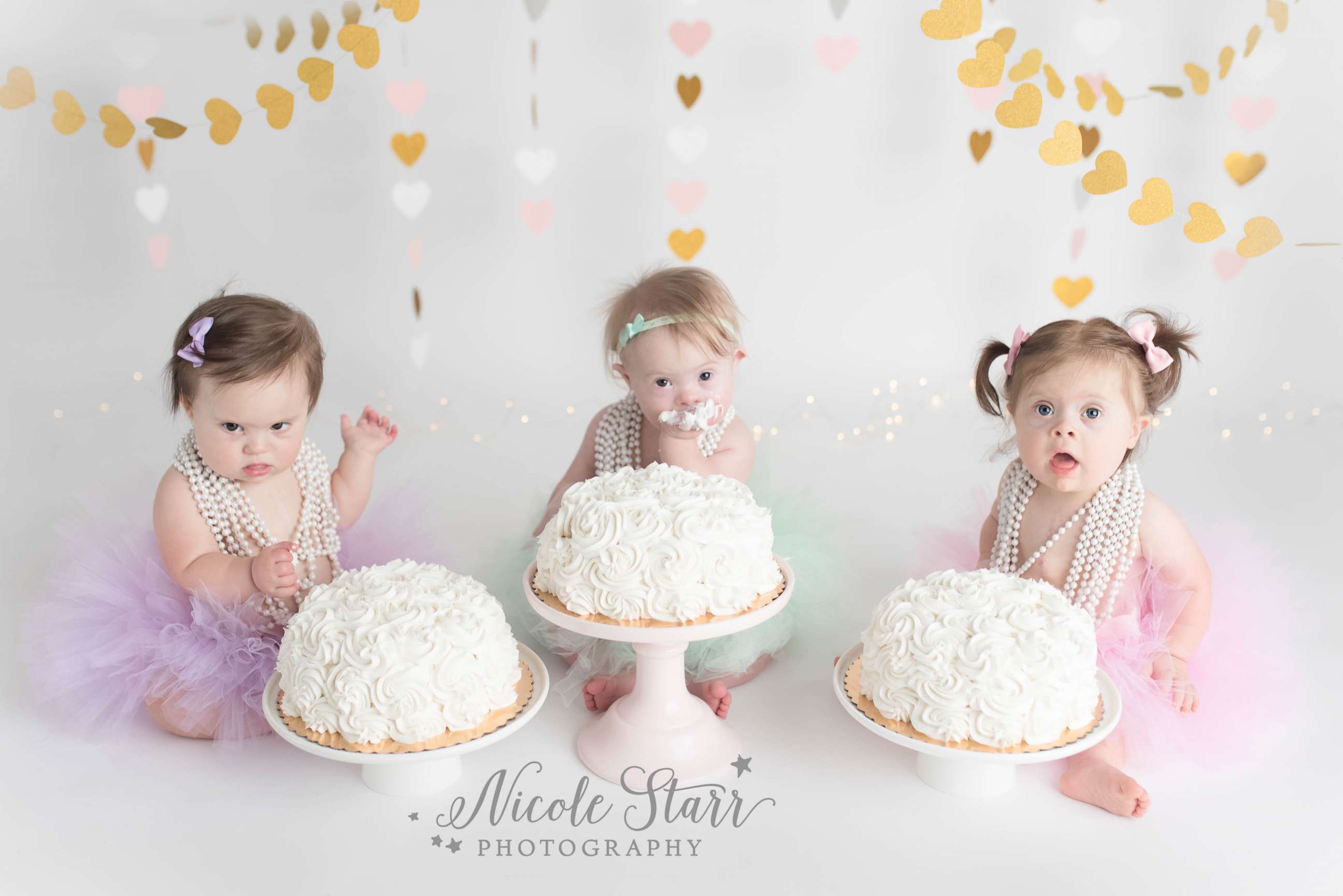PHOTO: Babies' Three of Hearts photo shoot celebrates Down syndrome and life after heart surgery.